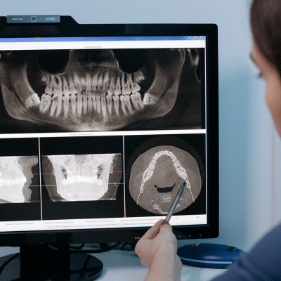 Dental professional examining an X-Ray, representing advanced dental care