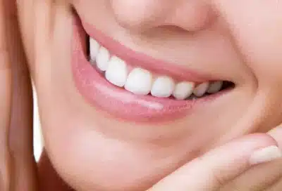 How cosmetic dentistry change lives 3 Woman displaying beautiful white smile with her hands beside her cheeks, representing how a smile makeover improves self-esteem